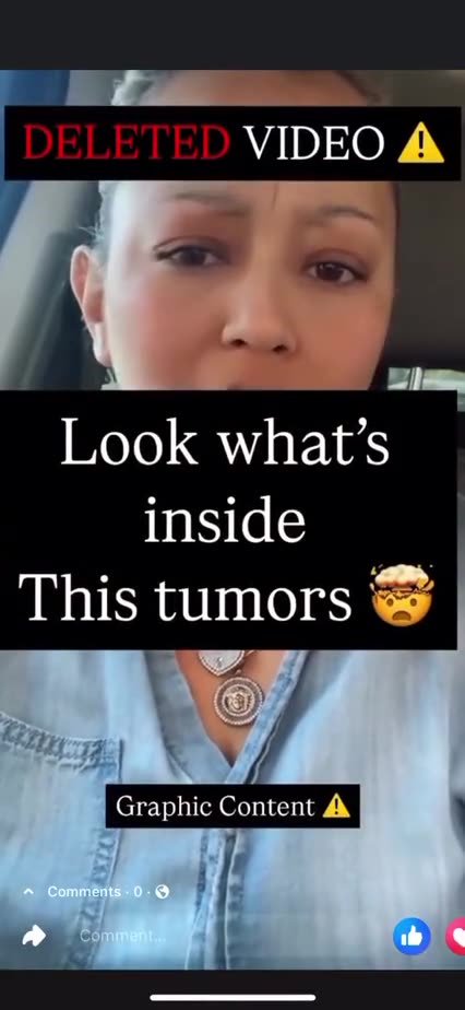 EVIDENCE THAT TUMORS 🦠 ARE PARASITES❗