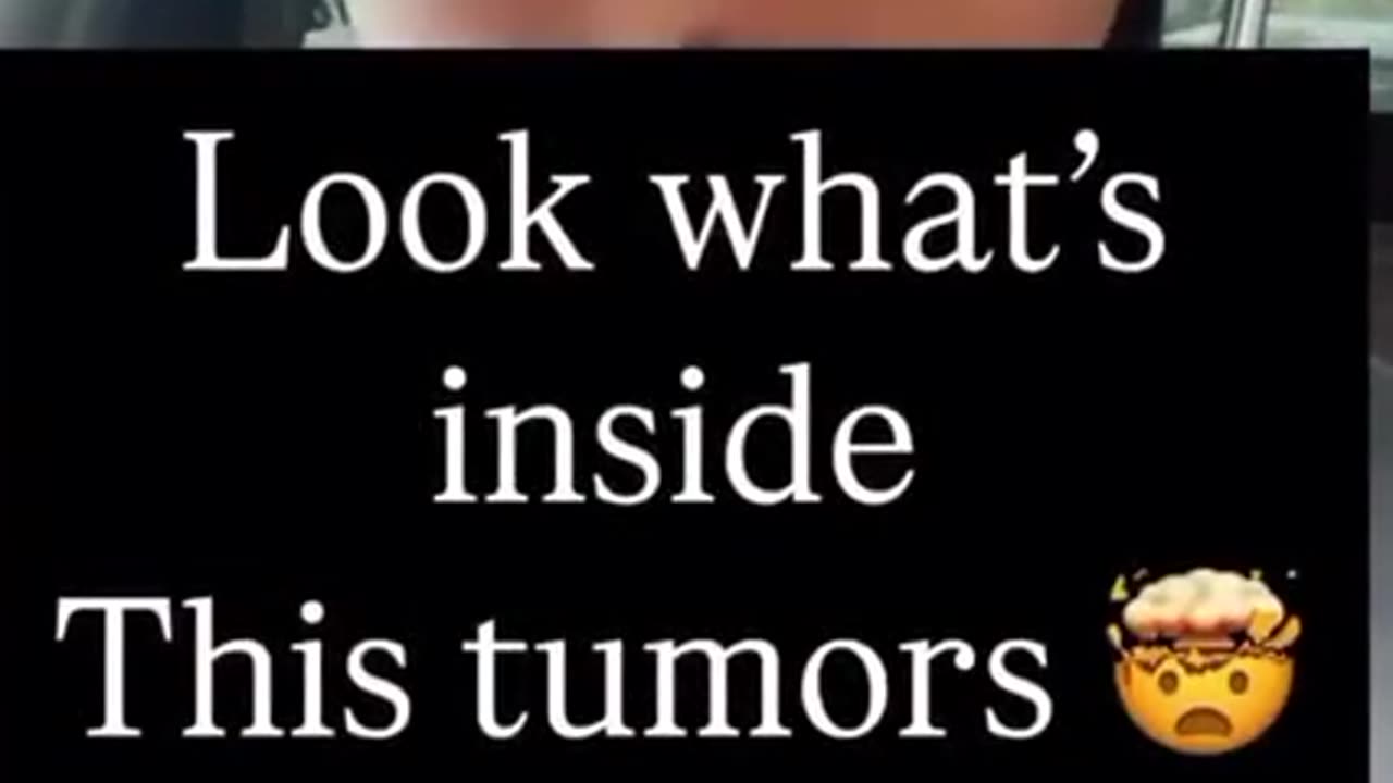 EVIDENCE THAT TUMORS 🦠 ARE PARASITES❗