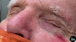 Delicate Milia Gems on the Face