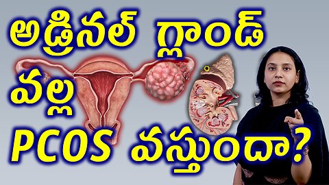 అడ్రినల్ గ్లాండ్ వల్ల PCOS వస్తుందా? Adrenal PCOS Causes Symptoms Tests Homeopathy Treatment Cure