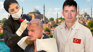 I flew a Stranger to Istanbul for a Hair Transplant