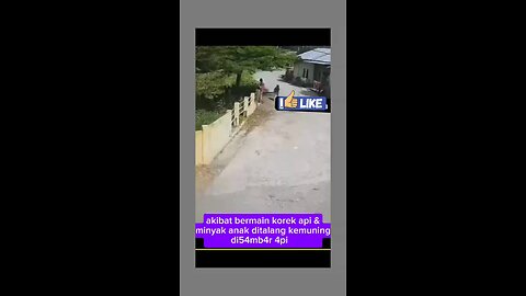 boy's whole body burned