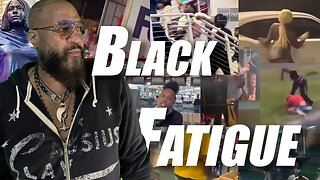 #BlackFatigue Tells Us White People Are Going To Retaliate | CALL IN SHOW | Hard R Podcast Ep. 41
