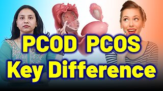 Don’t Confuse PCOD with PCOS! Here’s Why. | Treatment & Cure | Homeopathy, Medicine & Surgery