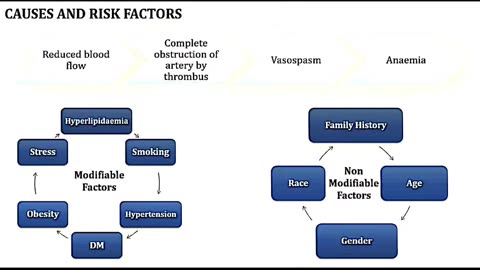 Myocardial infarction