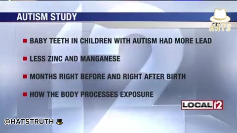 Researchers studied the baby teeth of children with autism & found higher levels of metal in them.