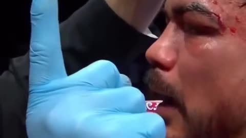 😂🔥 You Won't Believe How Good He Is! | FunFM