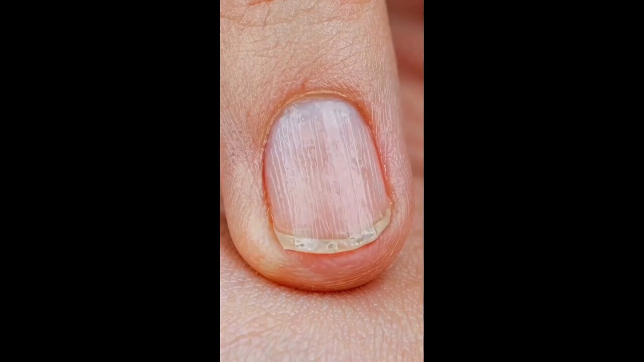 Nails