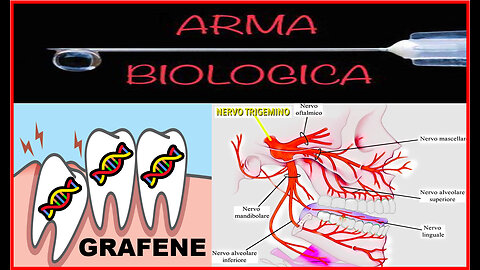 🤫​🤫​🤫​​... Il dente del "🦷​GIUDIZIO🦷" ​🙈​🙉​🙊​...