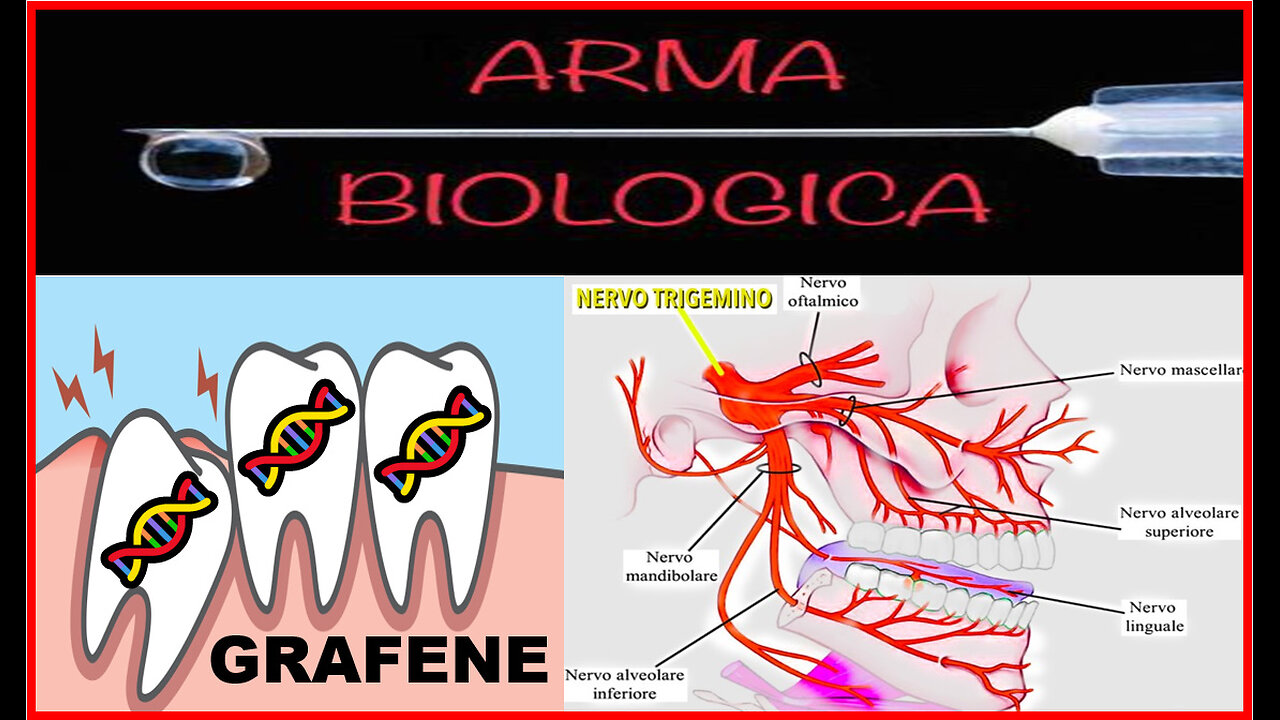 🤫​🤫​🤫​​... Il dente del "🦷​GIUDIZIO🦷" ​🙈​🙉​🙊​...