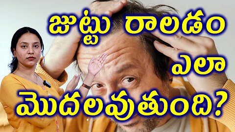 జుట్టు రాలడం ఎలా మొదలవుతుంది?Body Changes Due to Hair Fall in Men or AndrogeneticAlopecia Homeopathy