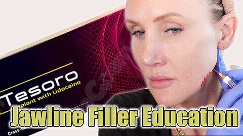 Jawline Filler Education - Sharper Jawline & Jowl Reduction