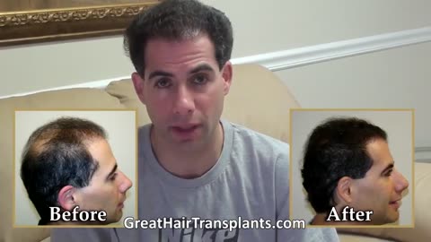 Advanced Robotic Hair Transplant Solutions in Anaheim, California - promo