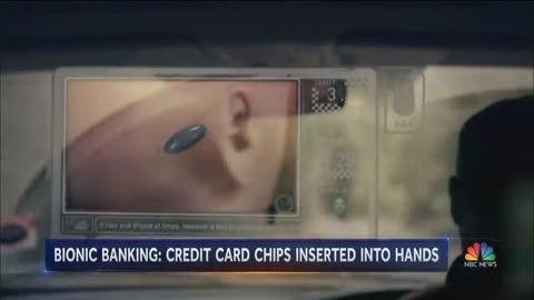 Media and Society's social acceptance of RFID implant technology inserted in the hand