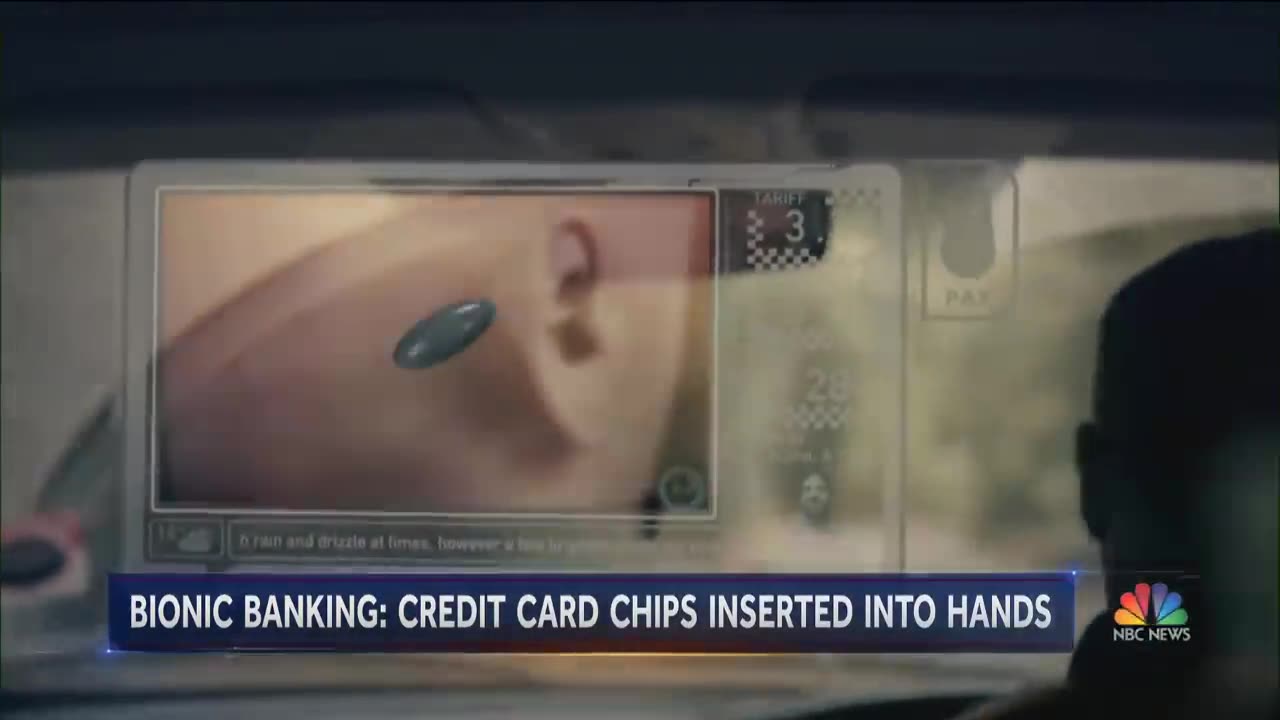 Media and Society's social acceptance of RFID implant technology inserted in the hand