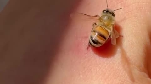 Sometimes bees sting by accident and try to unwind their stinger
