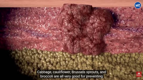 13 Best Foods To Keep Your Pancreas Healthy For Longer