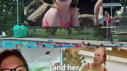 A 66-year-old woman injures a 7-year-old with down syndrome at a community pool
