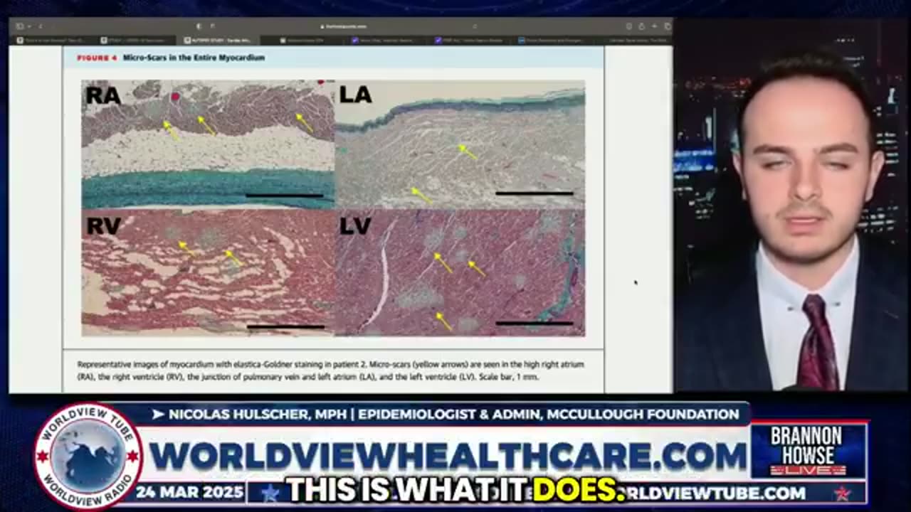 After five mRNA booster shots