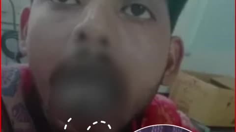 Ghaziabad Horror: Wife Cuts Off Husband's Tongue After Argument Over Cooking | Modinagar