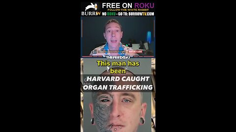 Harvard Morgue Manager Has Been Selling Body Parts From Donated Body Parts