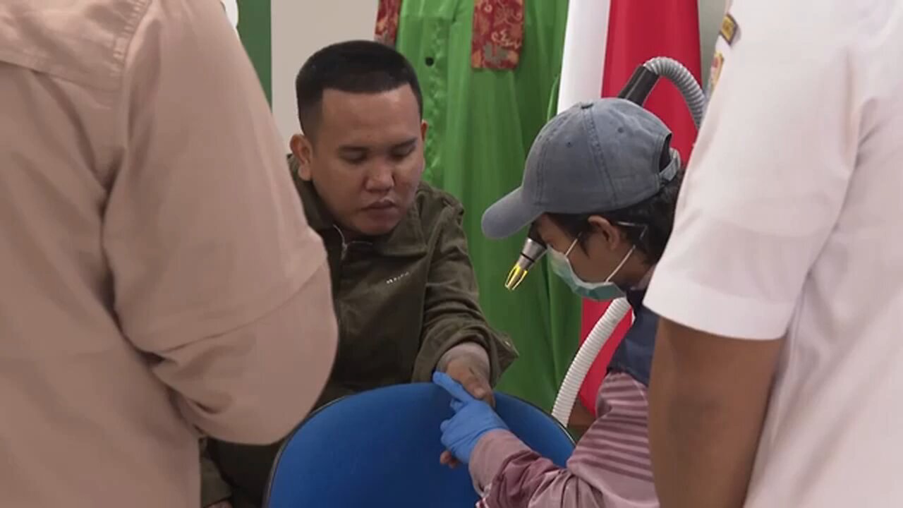 Indonesians with tattoo regrets flock to free removal service during Ramadan