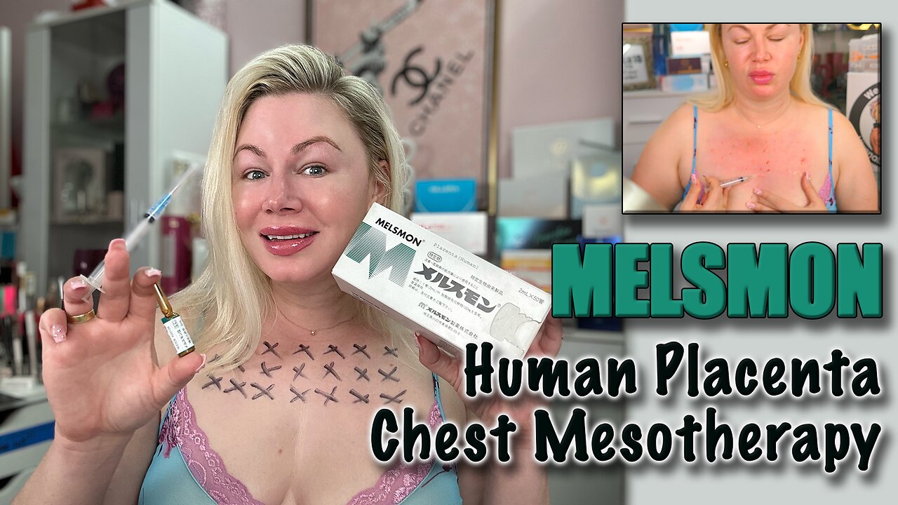 Melsmon, Human Placenta Chest Mesotherapy! AceCosm.com and code Jessica10 saves you money