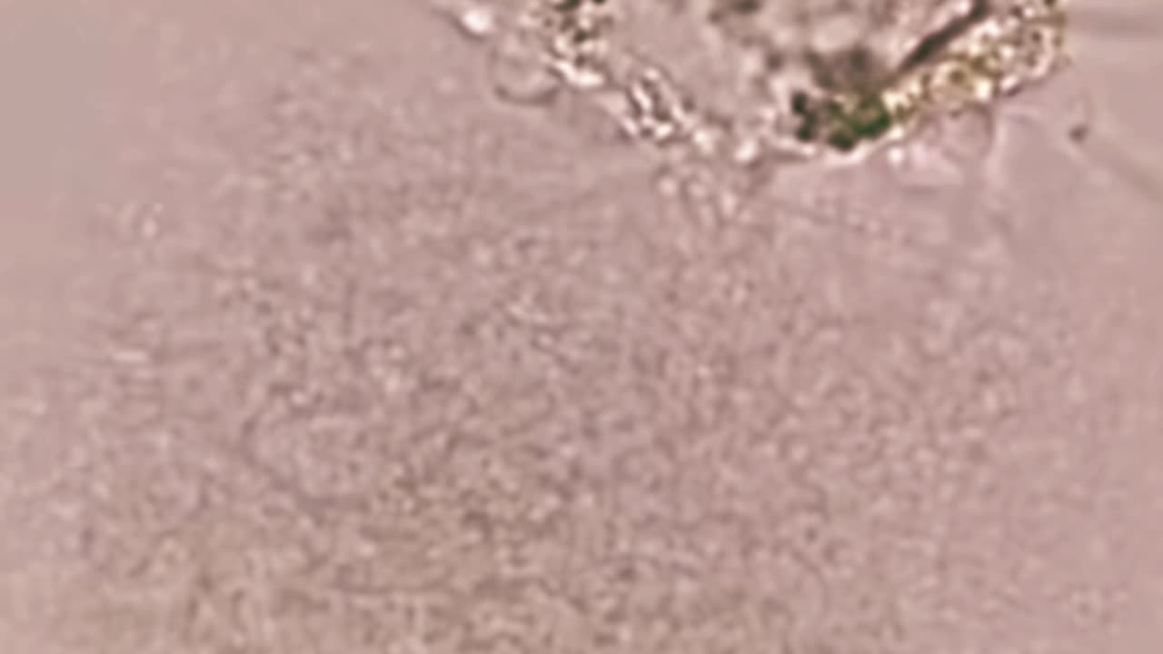 What happens when the parasites die?