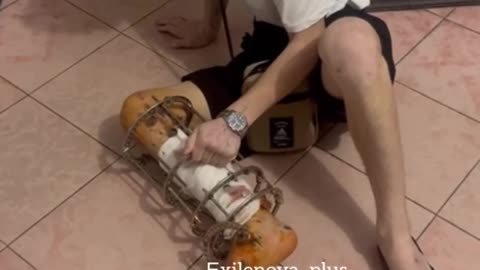 Discharged Russian Soldier Forced to Crawl Home