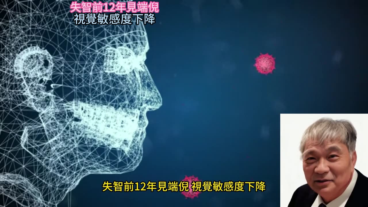 失智前12年見端倪 視覺敏感度下降