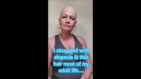 September is Alopecia Awareness month !!