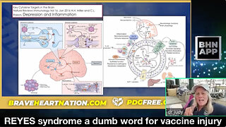 REYES syndrome a dumb word for vaccine injury