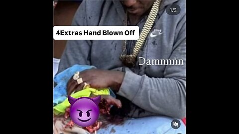 4XTRA Need 4XTRA fingers | Donate To His GoFund Me Now 🖖🖖🖖🖖