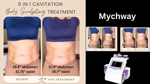 Wow! Check out my Results with Mychway 6in1 Cavitation - SASSY40 saves $40