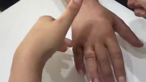 🤯✨ Witness Amazing Finger Restoration! | FeedMyCuriosity