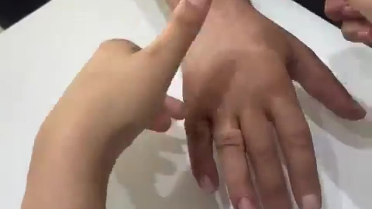 🤯✨ Witness Amazing Finger Restoration! | FeedMyCuriosity