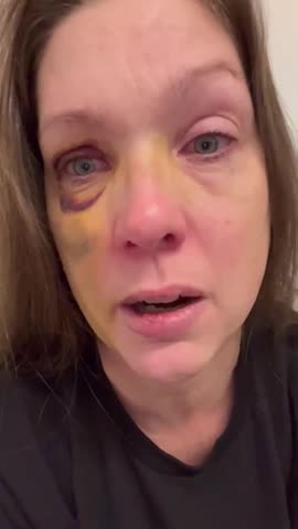 Holly has been in hiding since the vicious mob attack in Cincinnati.