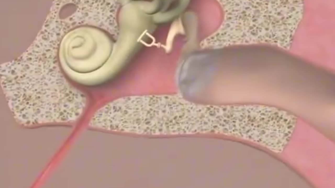 Eustachian Tube Balloon Dilation 3D Animation