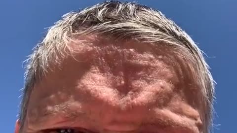 How much sun is too much with X39 patches ?