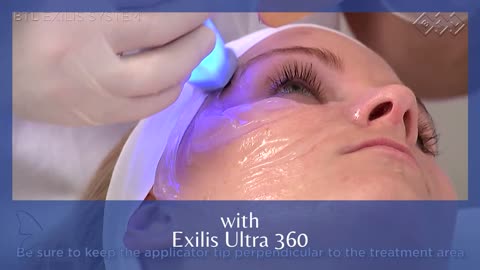 Renew Your Skin With BTL Exilis Ultra 360° in Singapore