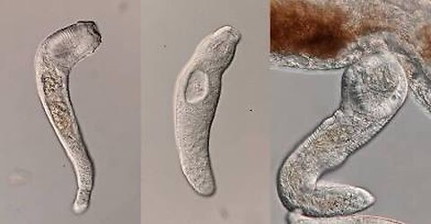 Cancer or parasites?