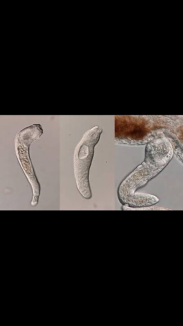 Cancer or parasites?