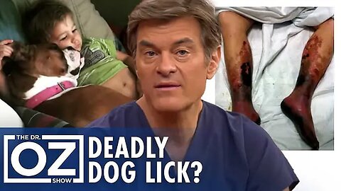 Dog Lick Dangers: Deadly Capnocytophaga Explained