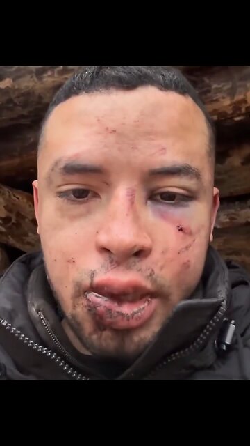 Mercenario colombiano denuncia secuestro por el Ejército de Ucrania