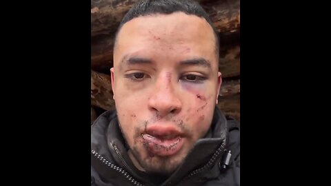 Mercenario colombiano denuncia secuestro por el Ejército de Ucrania