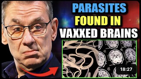 Scientists Discover "Parasitic Entities" in Brains of Jabbed - Media Blackout
