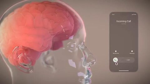 "First Human Successfully Implanted with Elon Musk's Revolutionary Brain Chip"