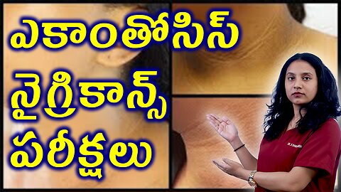ఎకాంతోసిస్ నైగ్రికాన్స్ పరీక్షలు | Acanthosis Nigricans Tests in PCOS Treatment Cure Medicine Clinic