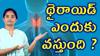 థైరాయిడ్ ఎందుకు వస్తుంది Causes For Thyroid Neck Gland Homeopathy Treatment Medicine Cure Surgery