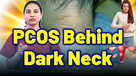 PCOS Causes Dark Neck, Dark Underarms, Skin Darkening, Acanthosis Nigricans. | Treatment & Cure |